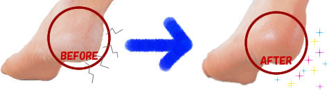�T�{�w�����ƃP�A�X���b�p
